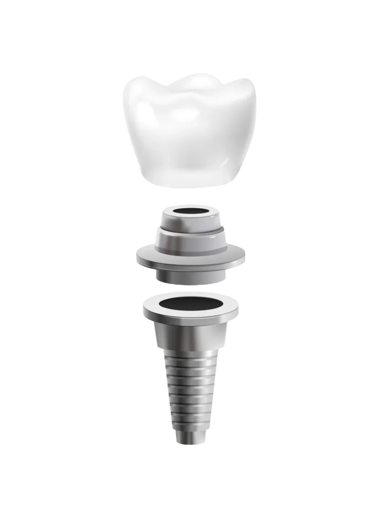 Dentist Performing Tooth Extraction – Elite Dental Inverness FL