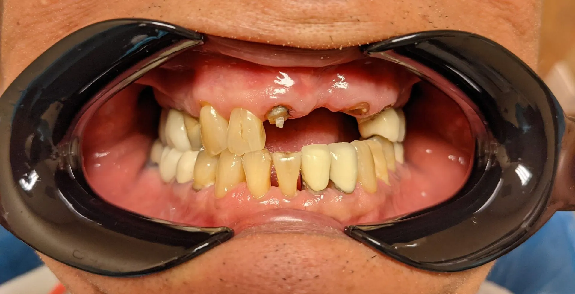 PXL_20201214_172537482.MP_-scaled-1920w